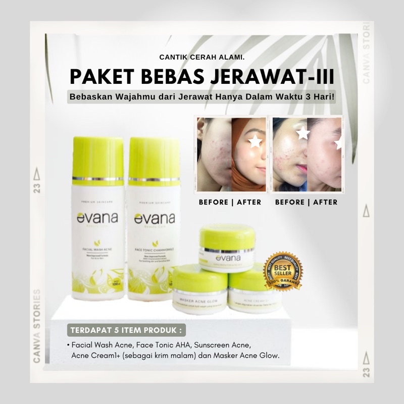 Evana Beauty Care Paket Jerawat III Tercepat Jerawat Hilang Dengan 3 Hari Paket Penghilang Jerawat -