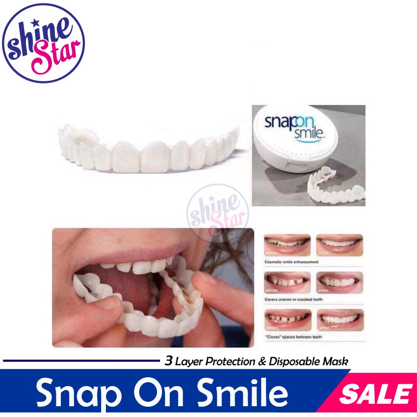 [ BAYAR TEMPAT ] Original 100% Snap On SMILE Sepasang Gigi Palsu Atas Bawah Cabut Pasang