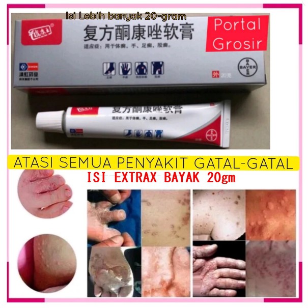 oBAT Gatal ampuh SALEP Jumbo 20.Gram PI KANG WANG Original - KL BL PKW Asli - Obat Gatal Kulit Exsim