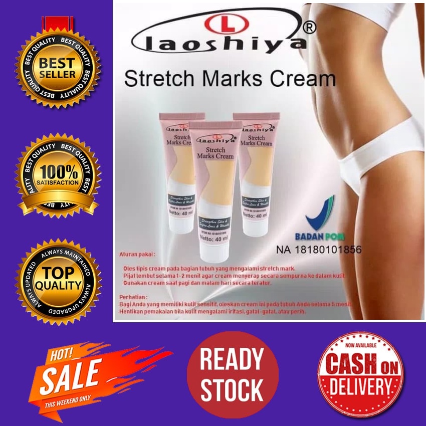 FZ -- Laoshiya Stretch Mark Cream