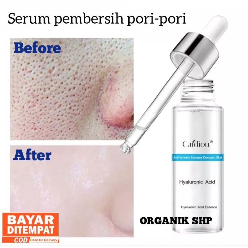 Serum pembersih pori-pori | Caidiou 15ml ORIGINAL 100%