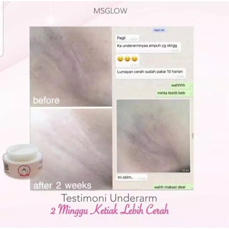 underarm MS glow | pemutih leher | pemutih ketiak | pemutih lipatan | cream lipatan | pemutih bokong