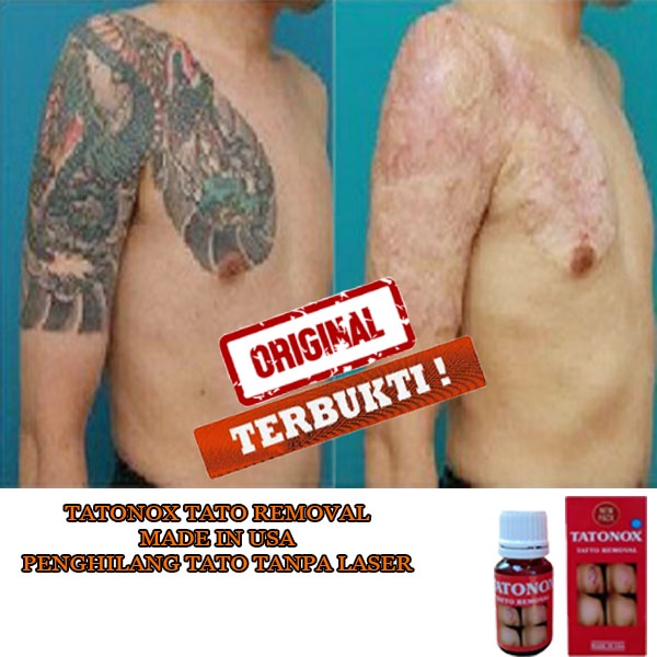 TATONOX ORIGINAL penghilang tato permanen penghapus tato asli tatonox asli