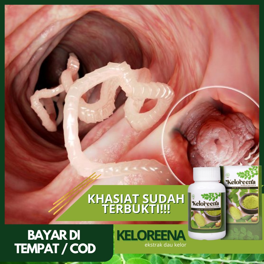 Obat Cacing Perut, Obat Cacing Kremi, Cacingan Untuk Dewasa & Anak Anak - KELOREENA