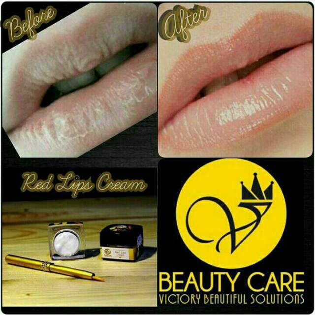 PROMO PEMERAH BIBIR / RED LIPS CREAM VITAMIN BIBIR V BEAUTY CARE - VICTORY BEAUTY CARE VBC