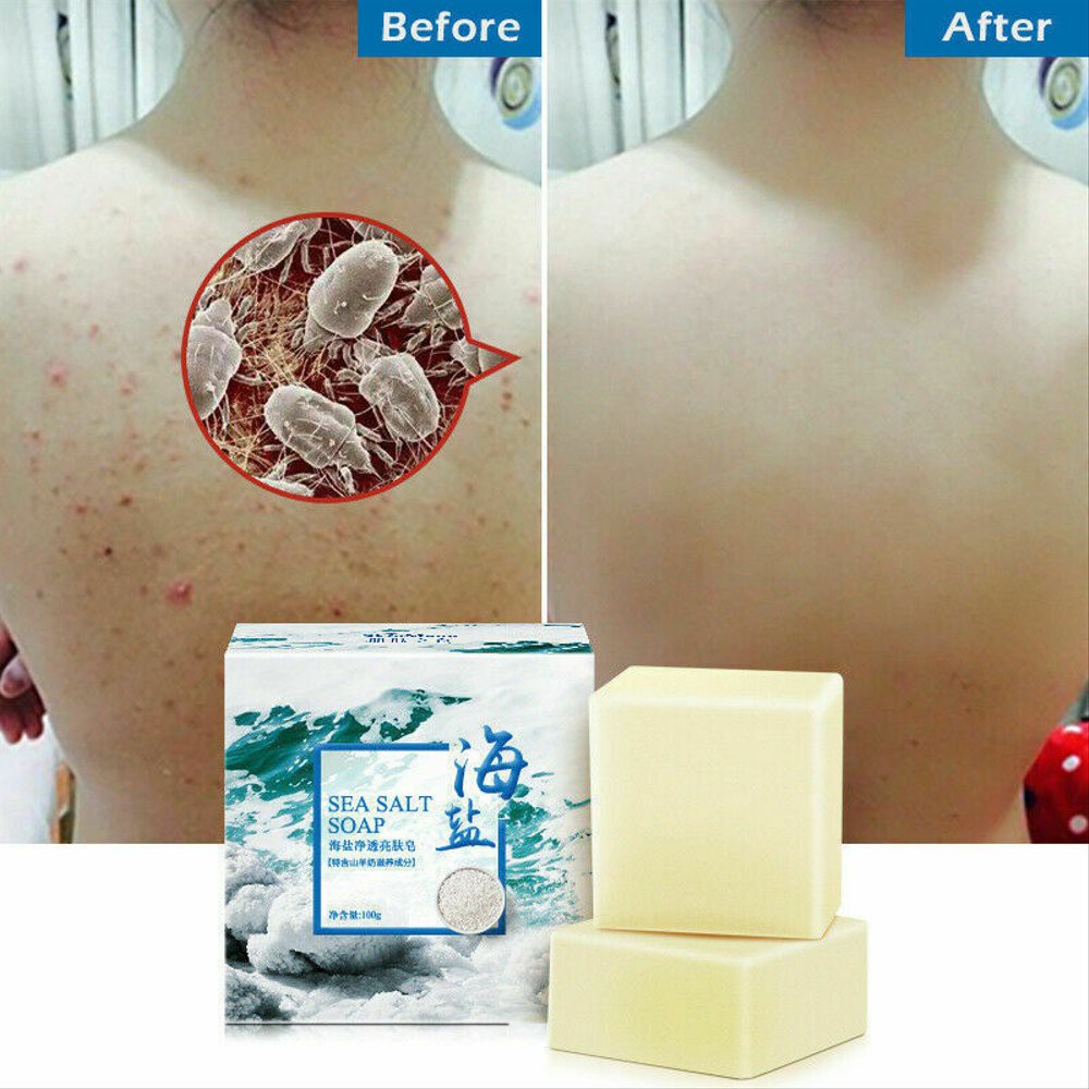 ORIGINAL Sea Salt Soap Sabun Jerawat Menghilangkan Jerawat Punggung Dan Muka