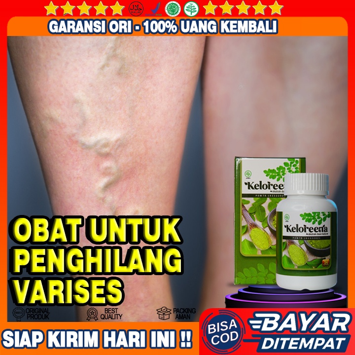 Jual Obat Penghilang Varises Di Kaki Menghilangkan Parises Di Tangan Betis Perut Wajah Testis Indonesia Shopee Indonesia