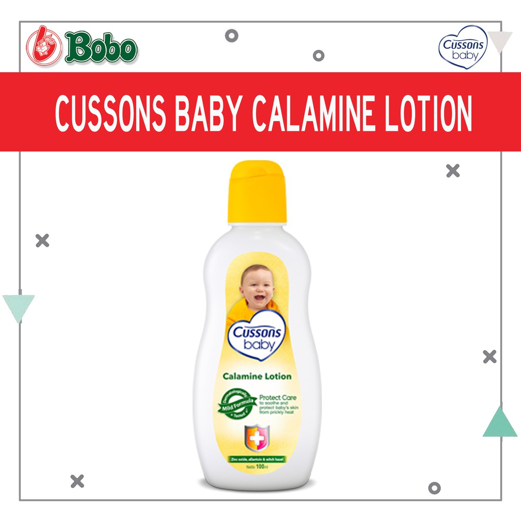 calamine lotion safe for babies