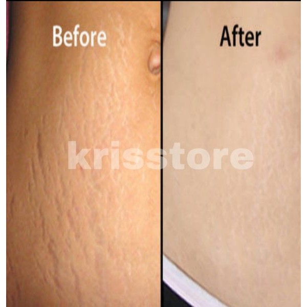 Promo pemutih ketiak ORIGINAL oxterwhite