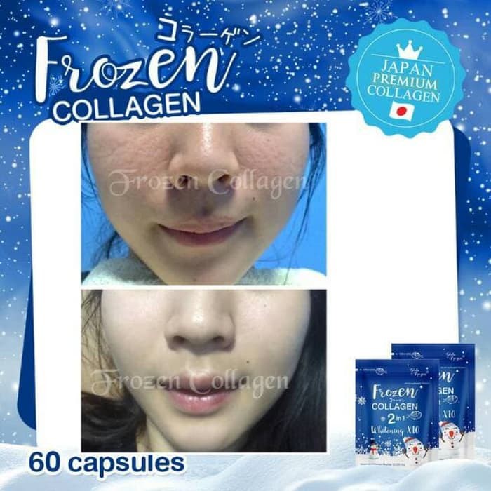 Unduh 940 Gambar Frozen Collagen Paling Baru HD