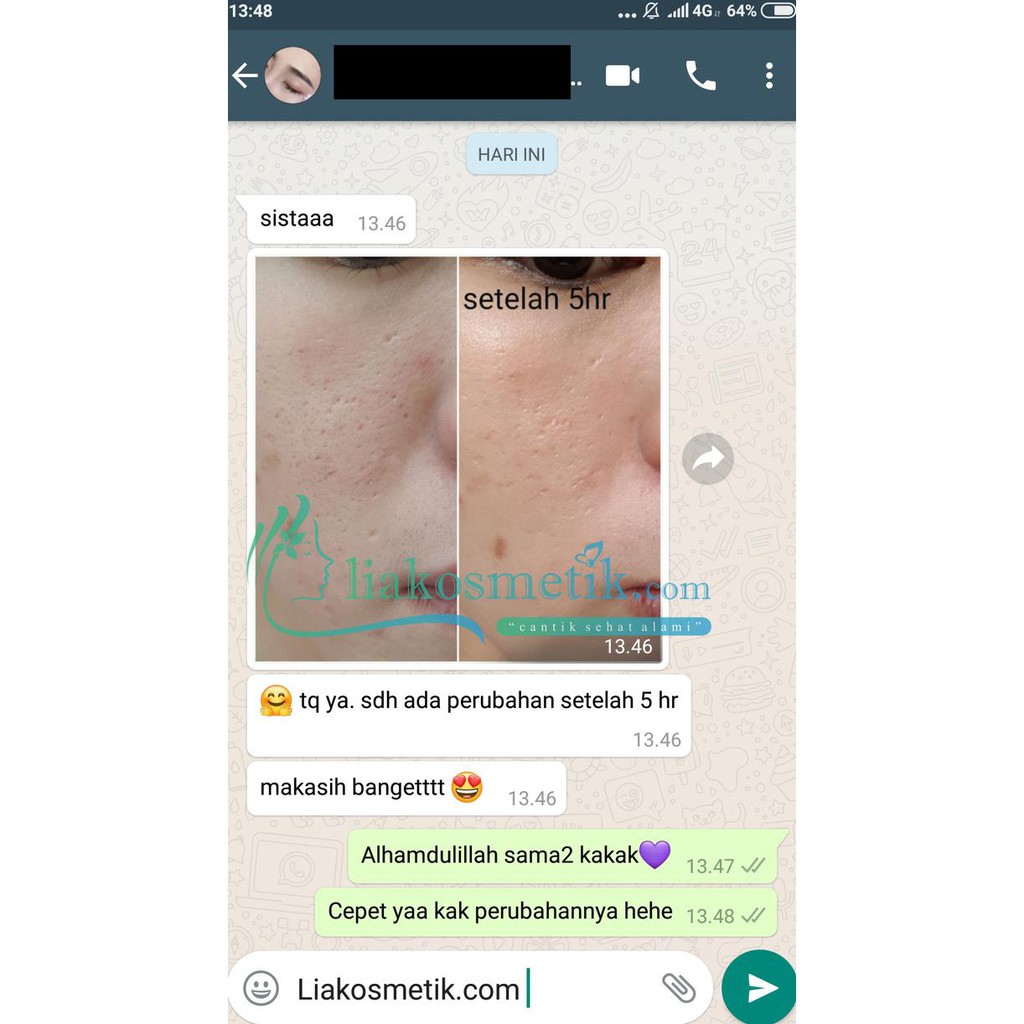 Pratista Centella Enrich Cream Penghilang Bopeng Ampuh ORIGINAL