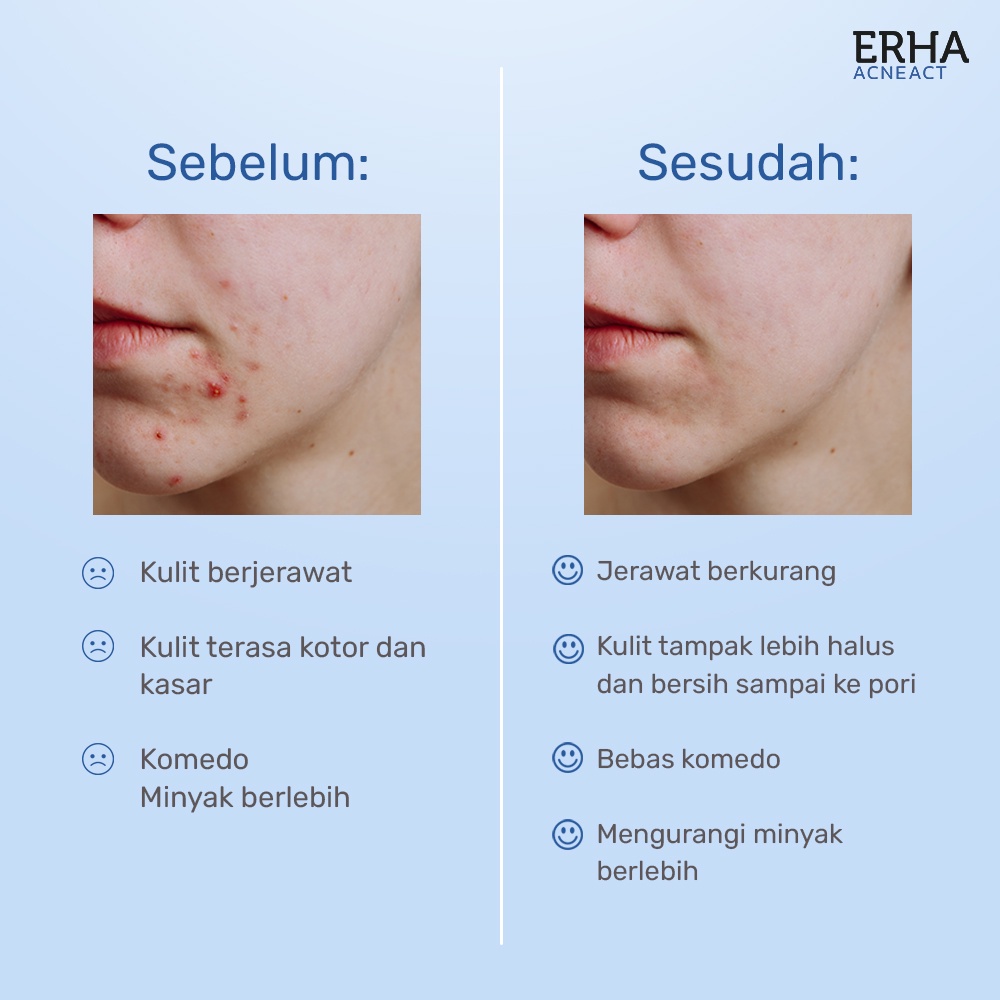 ERHA Acneact ACSBP Acne Cleanser Scrub Beta Plus 60g - Sabun Wajah Jerawat @MJ