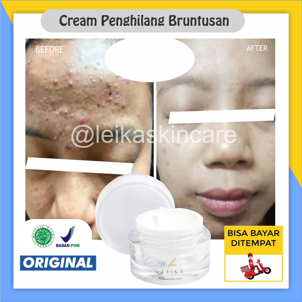 AMPUH CEPAT Cream Penghilang Bruntusan Dan Jerawat Perawatan Obat Bruntusan Wajah 100% ORIGINAL BPOM