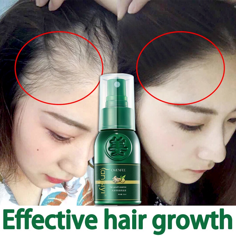 Perawatan Rambut Rontok Serum Rambut Rontok 30ml Semprotan Pertumbuhan Rambut Memelihara akar rambut dan memperbaiki folikel rambut