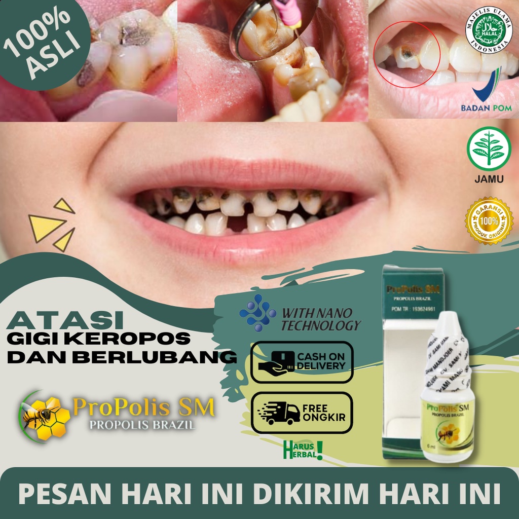 Obat Kumur Gigi Keropos, Obat Gigi Rusak, Obat Gigi Keropos Di Usia Muda,  Obat Gigi Keropos Sakit, 
