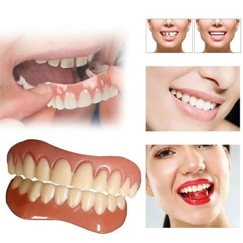Gigi Palsu Instan Perfect Smile Veneer Gigi Tiruan Bagian Atas