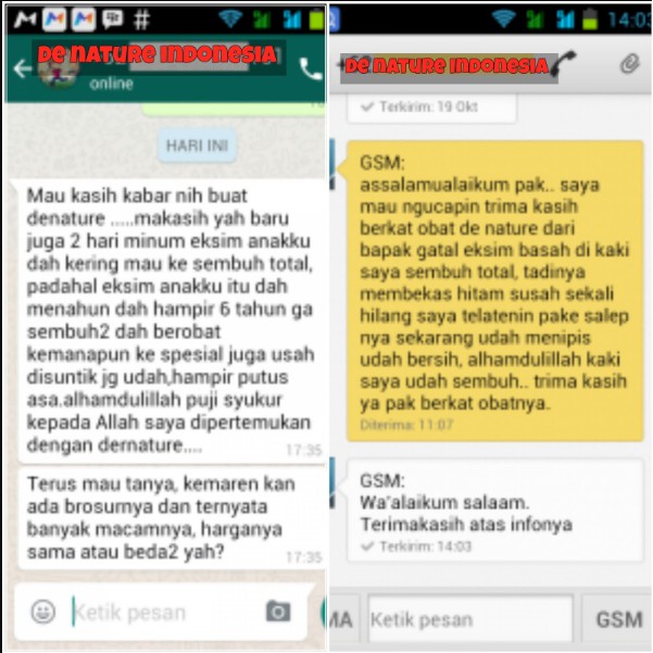 Salep+ Kapsul! Obat gatal2 | Kudis bintik merah Kulit | obat eksim kapsull minum hapur gatel Scabies-4