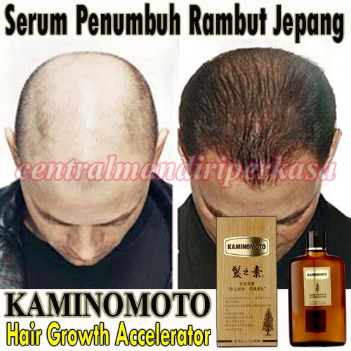 obat penghilang kebotakan kaminomoto asli serum herbal rambut Kaminomoto serum penumbuh rambut asli