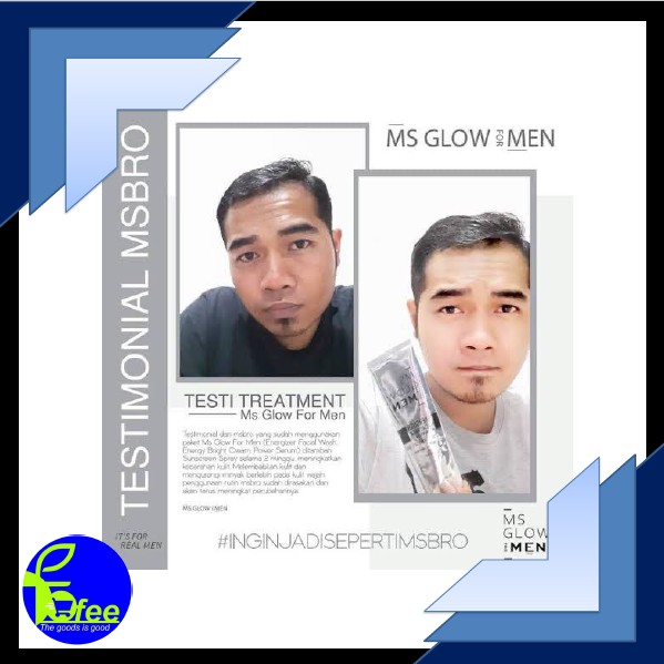 [LOCAL] - MS glow for men perawatan wajah pria