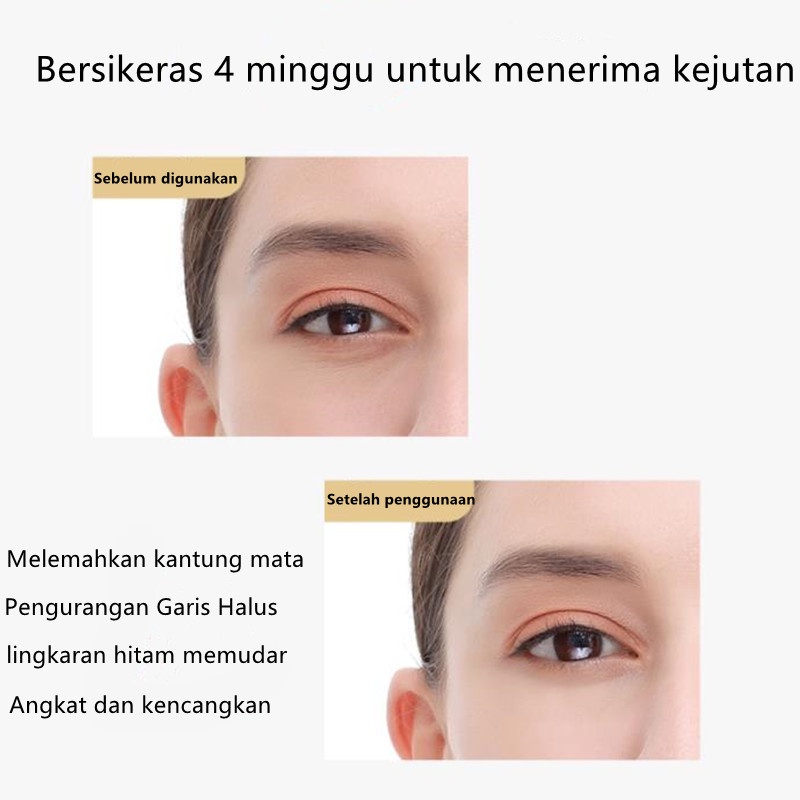 inFace Asli Untuk Menghilangkan Kantung Mata Radiofrequency Masagger Ion Negatif Eye Perangkat Kecantikan Alat Anti Dark Circle Vibrator Anti Kerut Dark Circle Removel Pengencang Kulit Wajah Memudar Lingkaran Hitam Anti Kerut Penuaan Bibir Leher