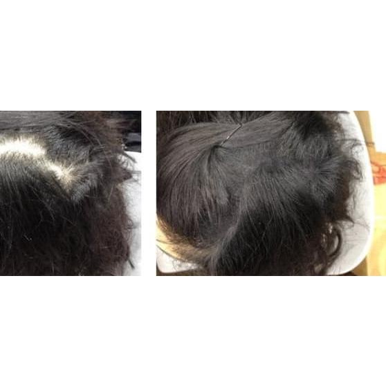 ✶ OCARE HAIR BUILDING FIBER REFILL 57g HITAM / RAMBUT ANTI BOTAK - Black, 25g ✩