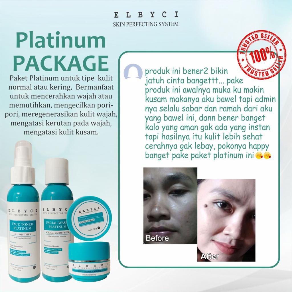 ELBYCI PAKET PLATINUM