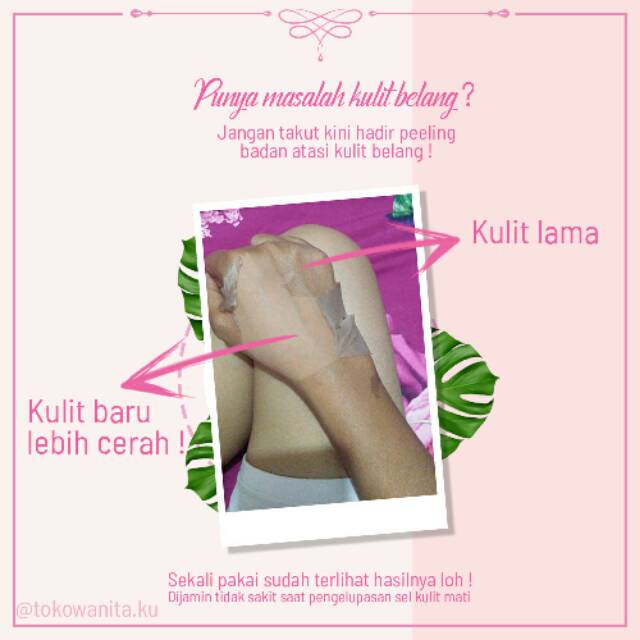 Peeling Badan