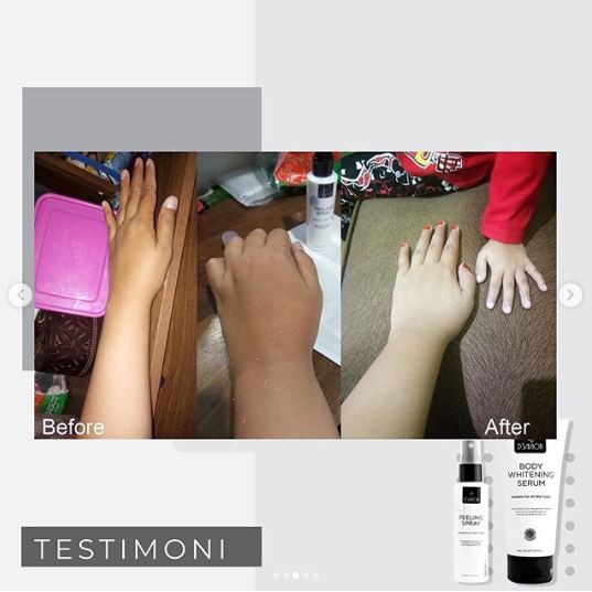 DSavior Whitening Body Serum [SALE COD] Dark Spot Peeling Spray Hand Lotion D Savior Original Paket Lengkap Brightening