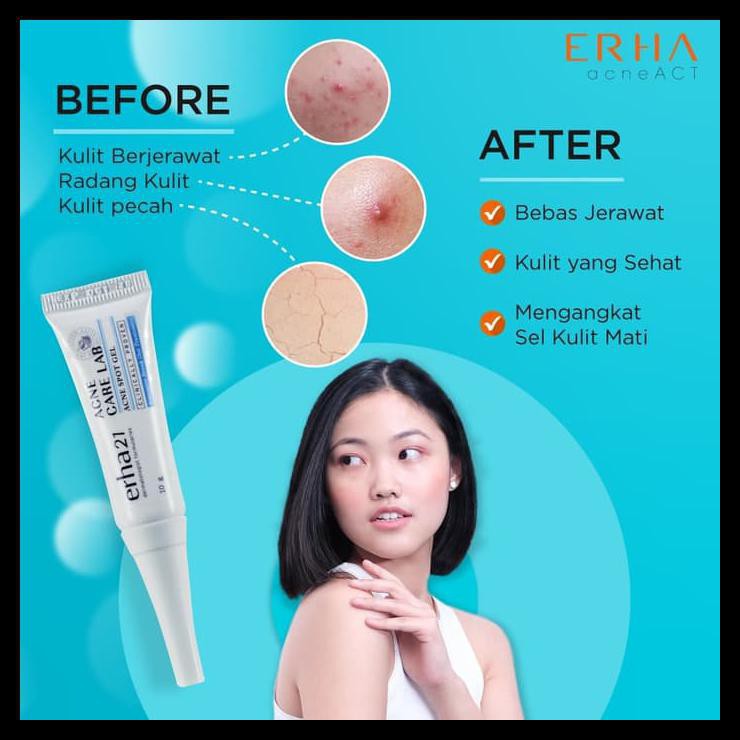 ERHA ACNE SPOT GEL OBAT TOTOL JERAWAT AMPUH BASMI JERAWAT BEST SELLER