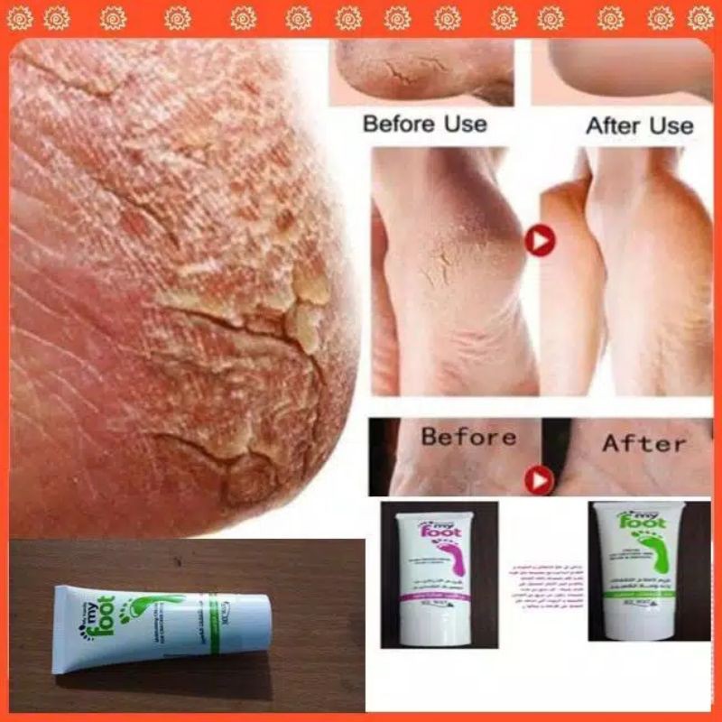 MY FOOT  CREAM MY WAY