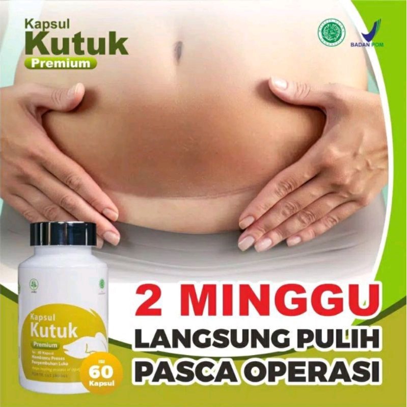 ORIGINAL KAPSUL KUTUK PREMIUM ASLI ALBUMIN EKSTRAK IKAN GABUS KUTUK OBAT LUKA OPERASI CAESAR SESAR GROSIR TERMURAH