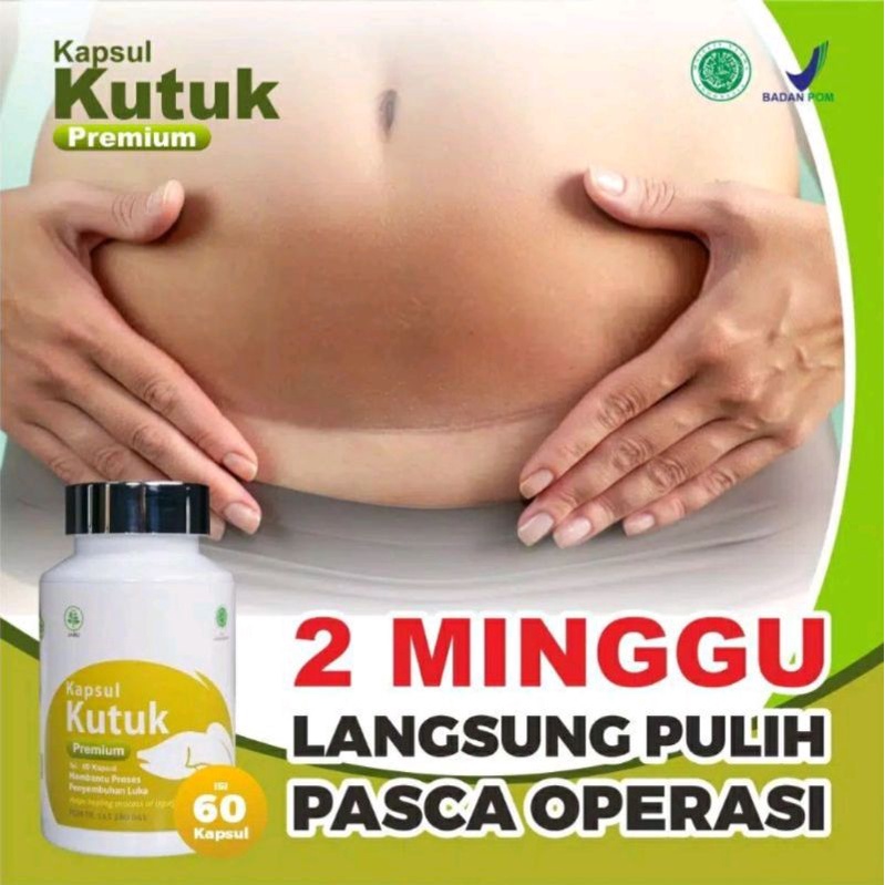 ORIGINAL KAPSUL KUTUK PREMIUM ALCHANNA, ALBUMIN, EKSTRAK IKAN GABUS, IKAN KUTUK IKAN GABUS OBAT LUKA OPERASI SESAR CESAR GROSIR TERMURAH