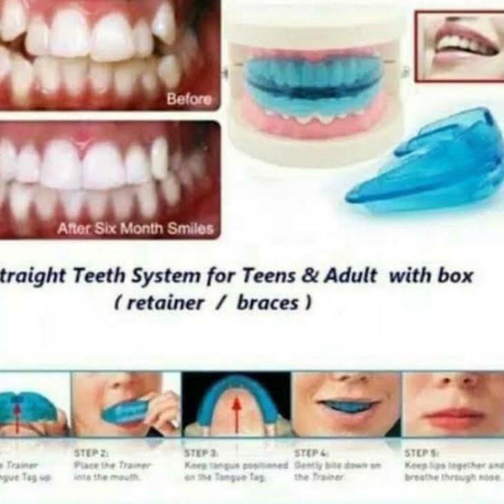 Menarik.. teeth trainer