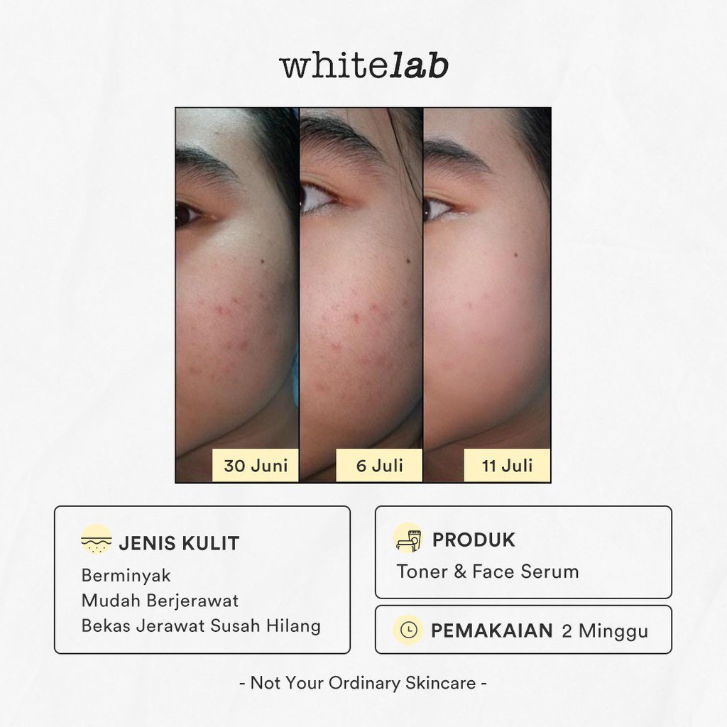 Whitelab Brightening Face Toner Whitening Perawatan Kecantikan Wajah Moisturizer Pelembab Muka BPOM