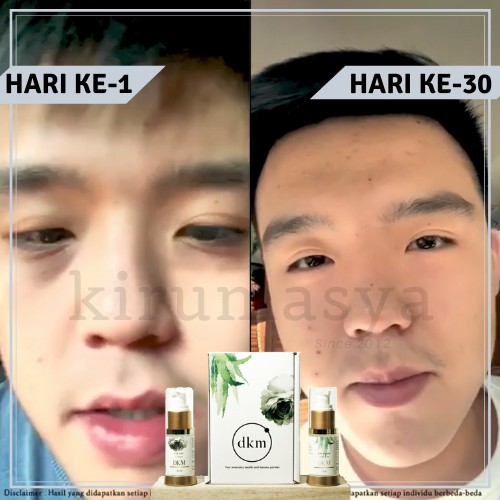 AMPUH PENGHILANG MATA PANDA / KANTUNG MATA | DKM EYE LIFT & SERUM | KRIM GEL | KANTONG MATA |