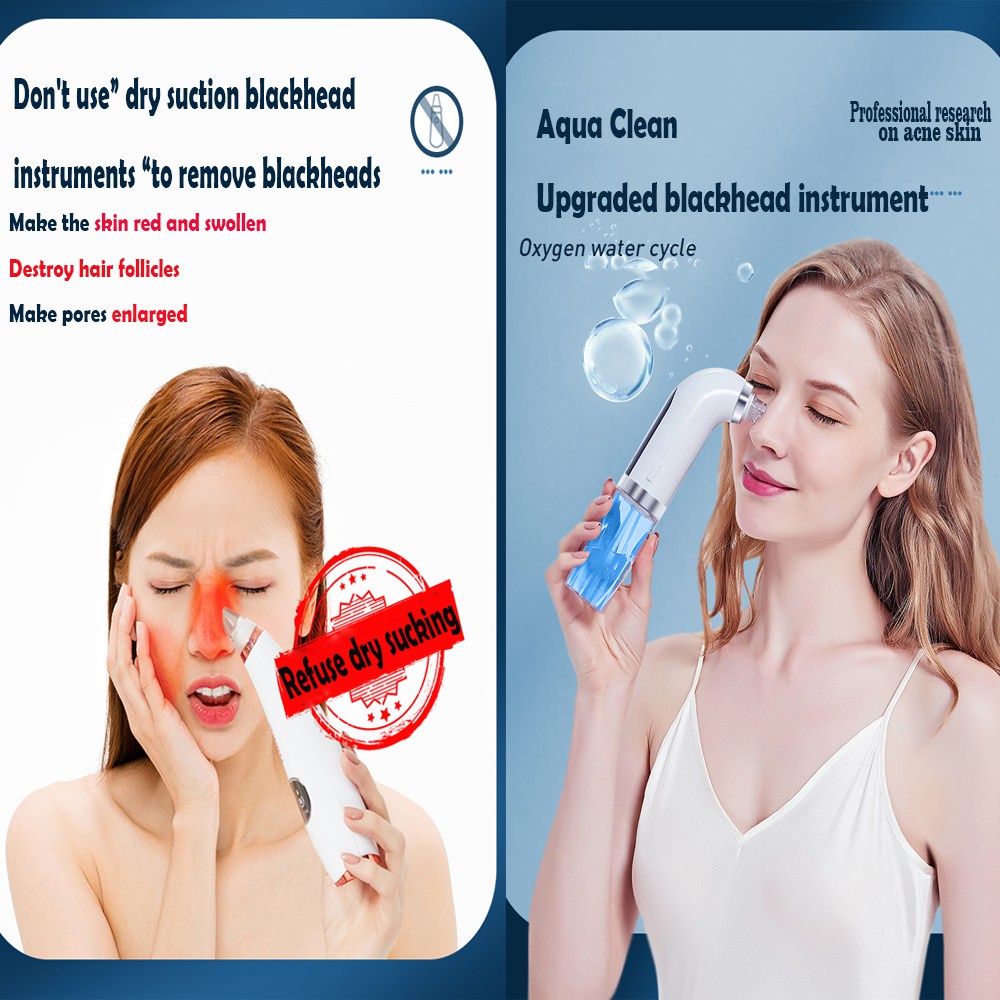 Alat Penyedot Komedo Sirkulasi Air /Vacuum Pori Blackhead Cleaner Rechargeable Blue Light