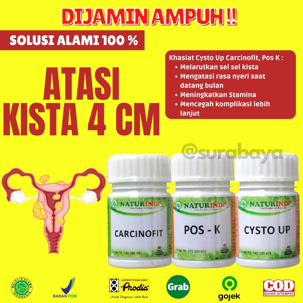 Obat Kista dan Miom Ovarium Obat Herbal Kista Bartholin Obat Penyakit Rahim Obat Cista Cysta Obat Miom Myom Coklat Obat Kista Endometriosis Ampuh Jamu Herbal Kista Miom Tumor Mioma Ampuh BPOM HALAL MUI CYSTO UP Naturindo Surabaya 40 Kapsul-KISTA 4 CM KEATAS
