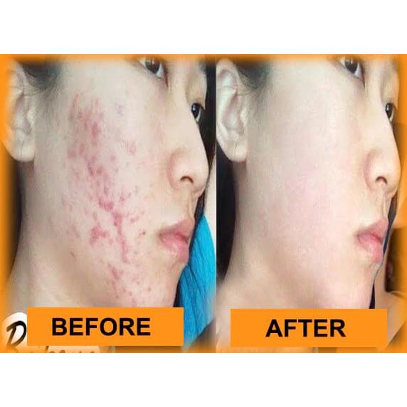 COD  SABUN espio colagen espio soap espio sabun espio ori J4