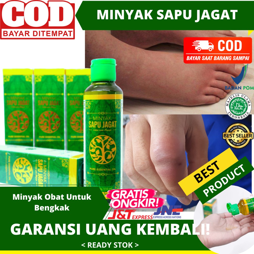 Jual Obat Bengkak Di Tangan Obat Kaki Bengkak Minyak Sapu Jagat Minyak Gosok Untuk Bengkak Bpom Indonesia Shopee Indonesia