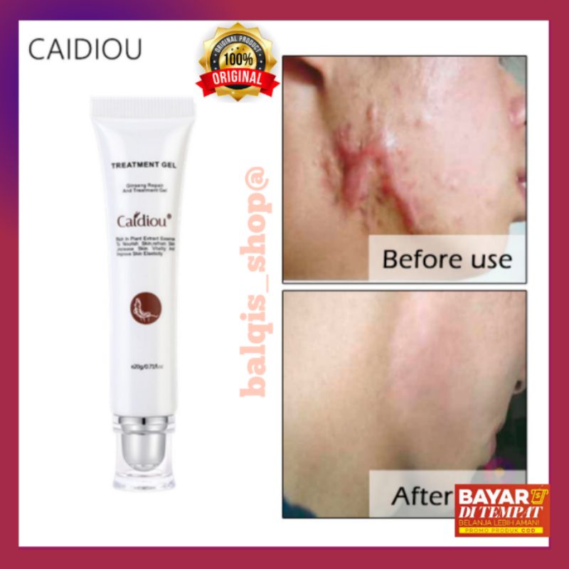 CAIDIOU GEL FORMULA TERBAIK PERBAIAKAN SERBA GUNA ORIGINAL