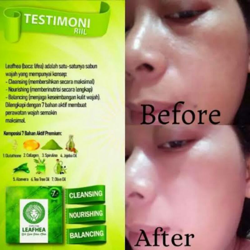 serum dan sabun leafhea