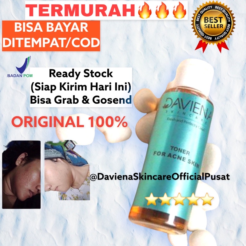 TERLARIS TERMURAH TONER ACNE SERIES | DAVIENA | DAVIENA SKINCARE | DAVIENASKINCARE Davina ASLI 100% 