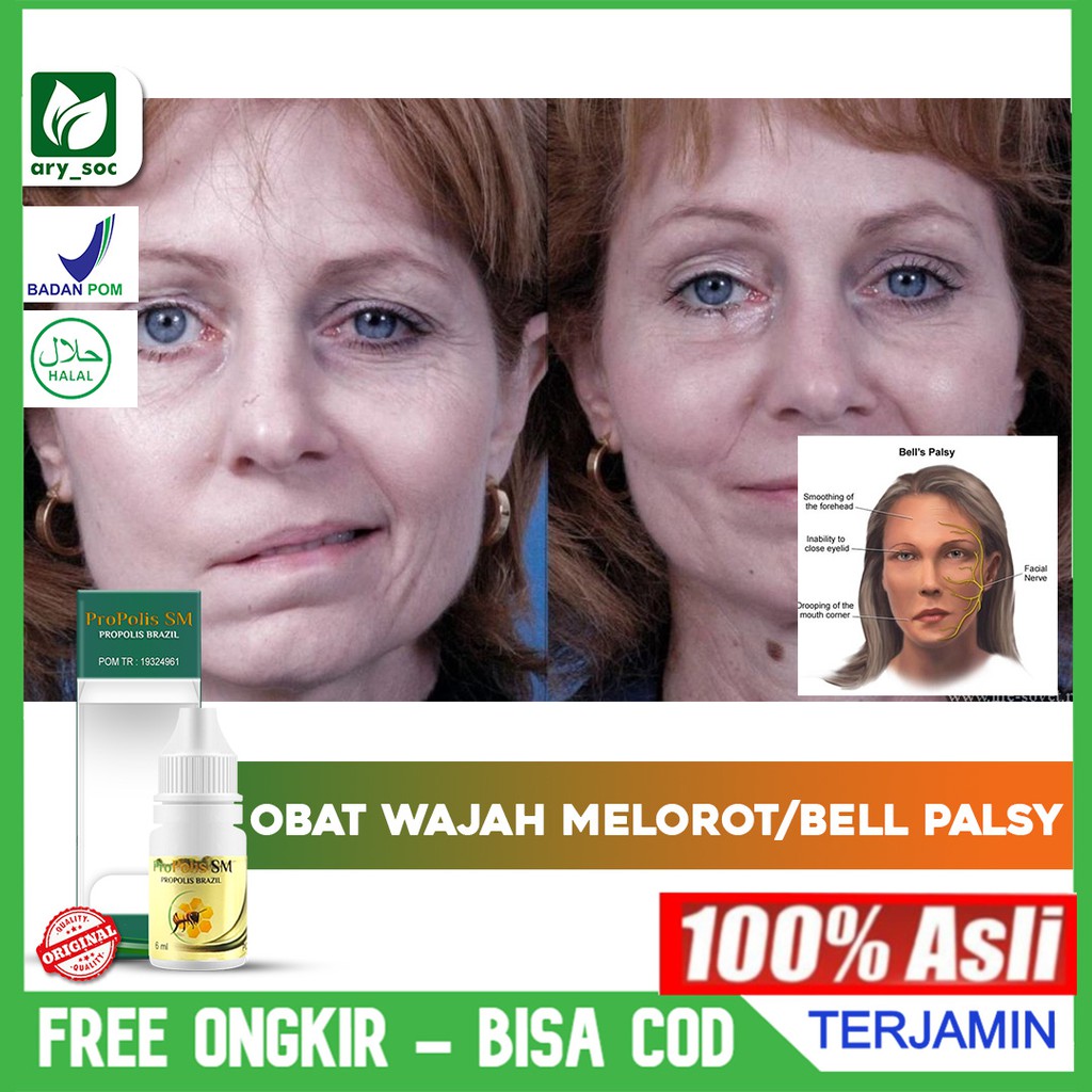 Jual Obat Bells Palsy Wajah Melorot Otot Wajah Lumpuh Anti Penuaan