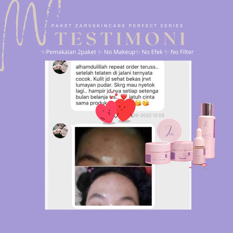 TERLARIS‼️ PAKET GLOWING PERFECT SERIES ZARV/ PAKET WHITENING / PAKET ACNE GLOWING / PAKET BRIGHTENING// zarv.skincare-7