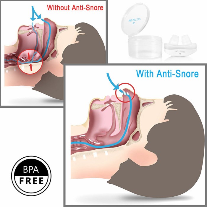 Anti Ngorok Anti Dengkur Anti Snoring Alat Pereda Mendengkur Hidung