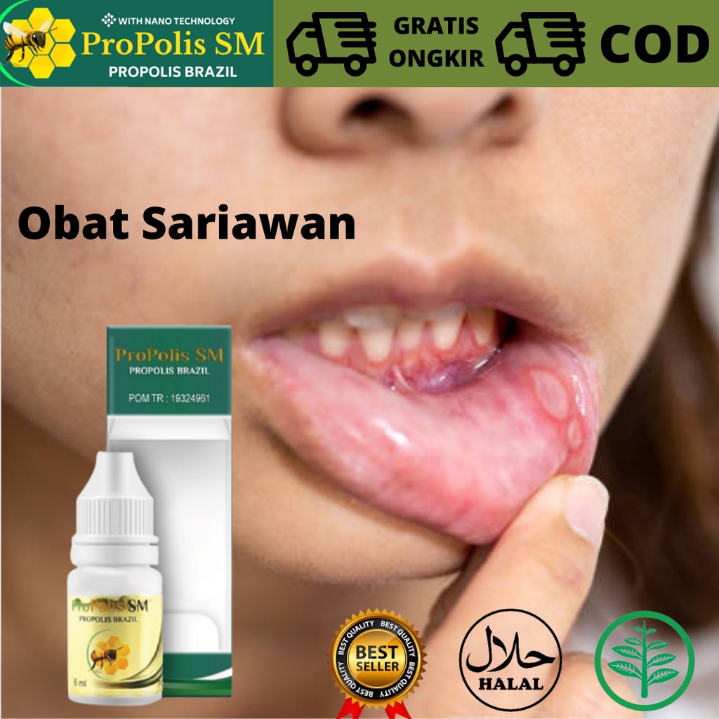 Jual Obat Herbal Mengatasi Sariawan Dan Panas Dalam Obat Sariawan Bengkak Dan Bernanah Obat 6376