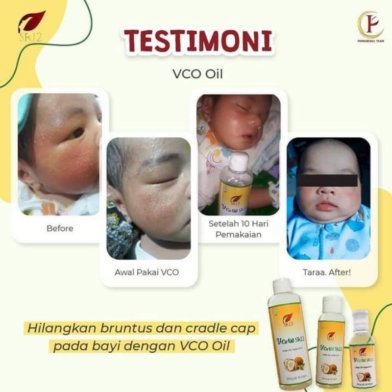 VCO SR12 MINYAK KELAPA MURNI  / VICO SR12 / VIRGIN COCONUT OIL / MINYAK KELAPA MURNI SR12 / VICO OIL SR12 / PENAMBAH IMUN TUBUH / SIAP NEW NORMAL