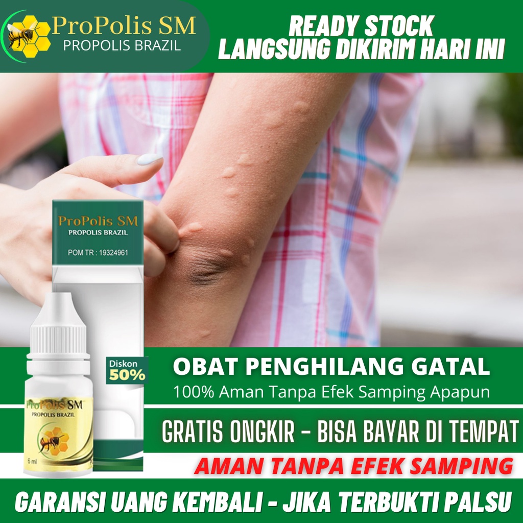 Obat Gatal Pada Kulit, Gatal Seluruh Badan, Gatel Bernanah, Gatal Berair, Bintik Merah, Gatal Di Kem