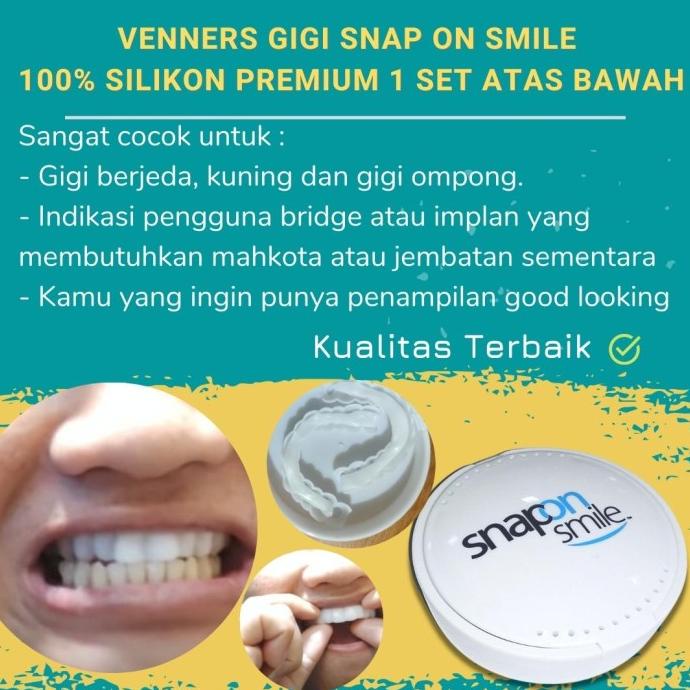 VENEER SNAP ON SMILE GIGI PALSU SILIKON BERKUALITAS 1 SET PELAPIS GIGI