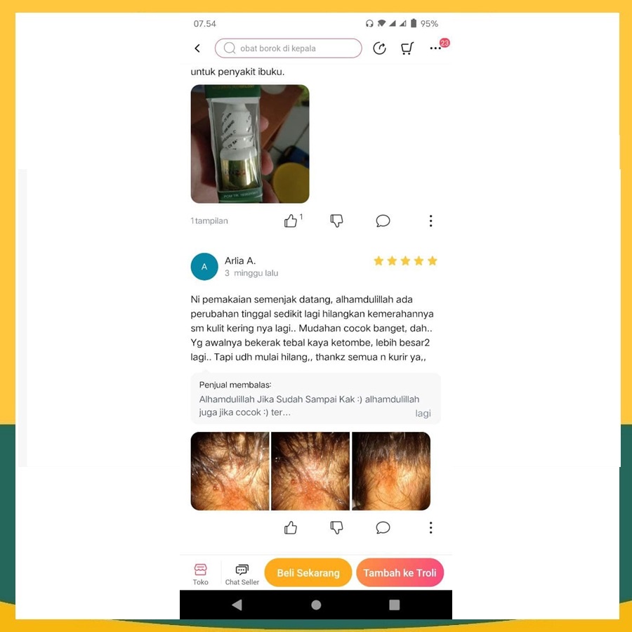 1 OBAT SALEP EKSIM, GATEL, KORENG, BOROK KARENA BAKTERI, BOROK DI SELANGKANGAN, BOROK DI KEPALA, OBAT BUDUG OLES ALAMI, OBAT BUDUG DI KAKI, OBAT PENGHILANG BEKAS KORENG - PROPOLIS SM BRAZIL 6 ML-1